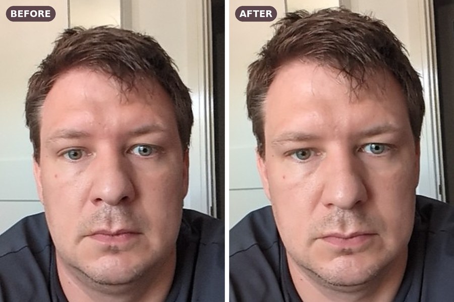 Men's anti-wrinkle case study before and after